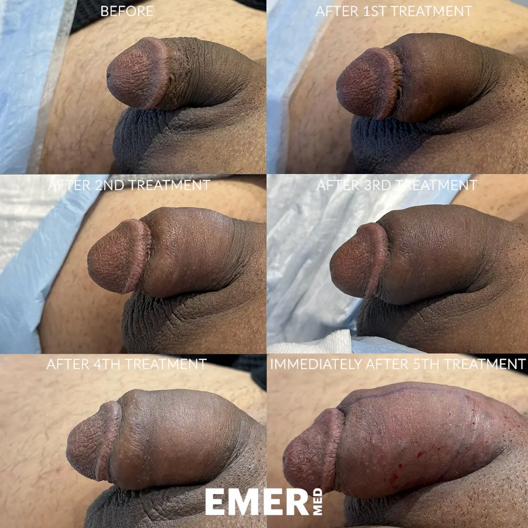 RG_6_P_01