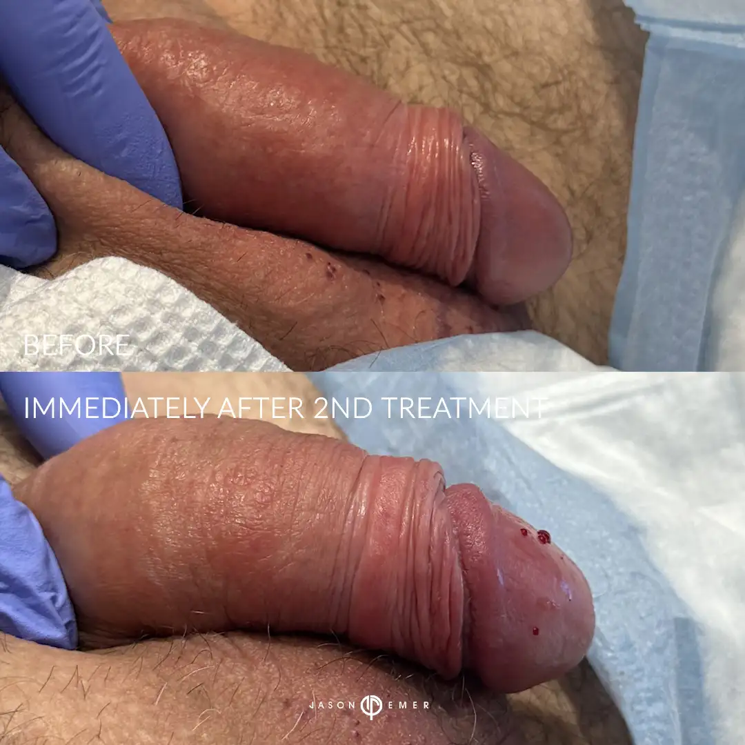 SV_H_BIA_2_01