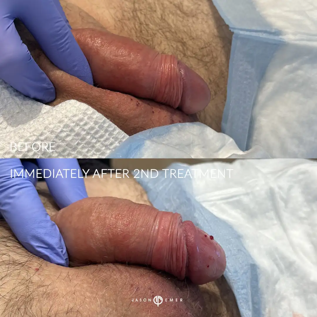 SV_H_BIA_2_far_01