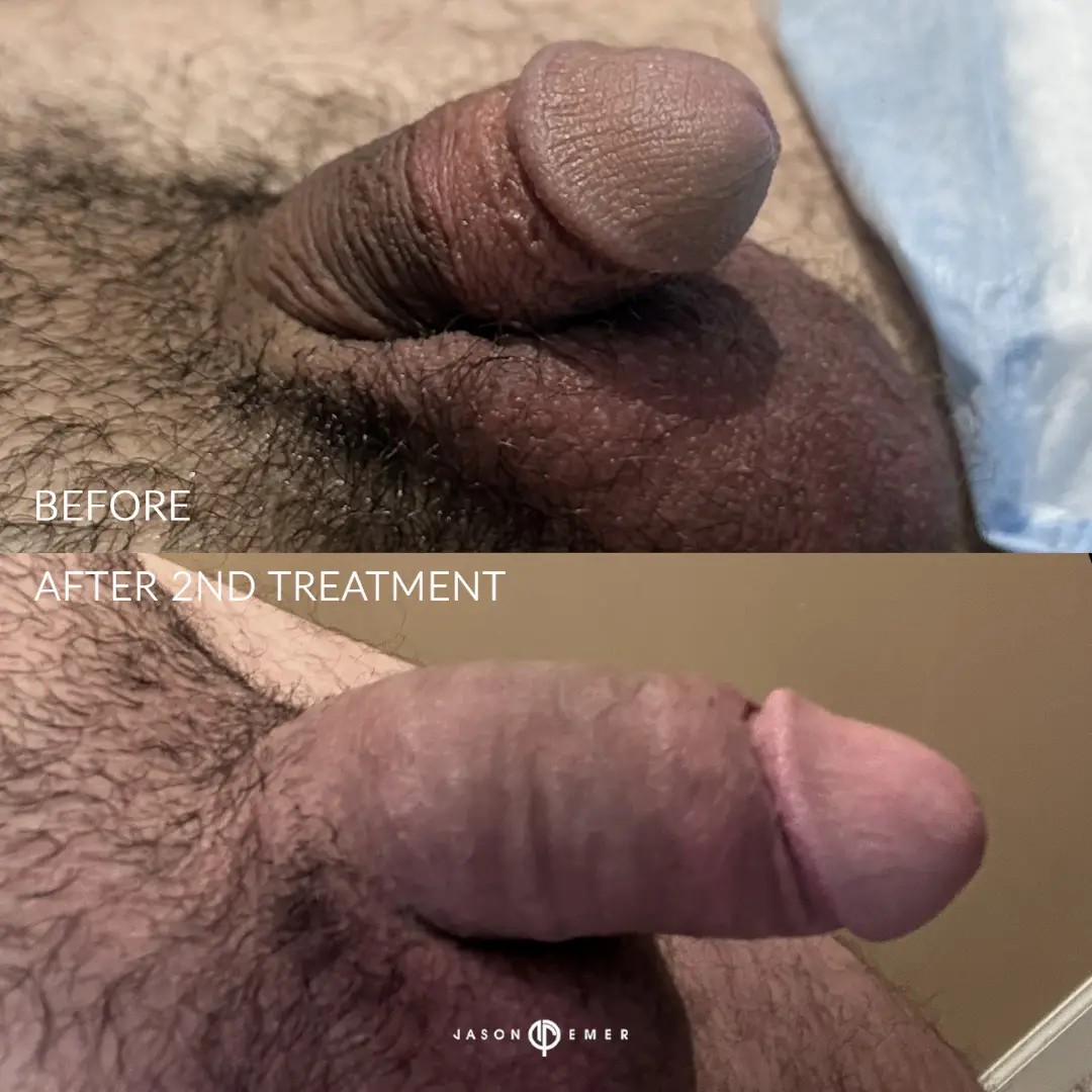 T_J_03