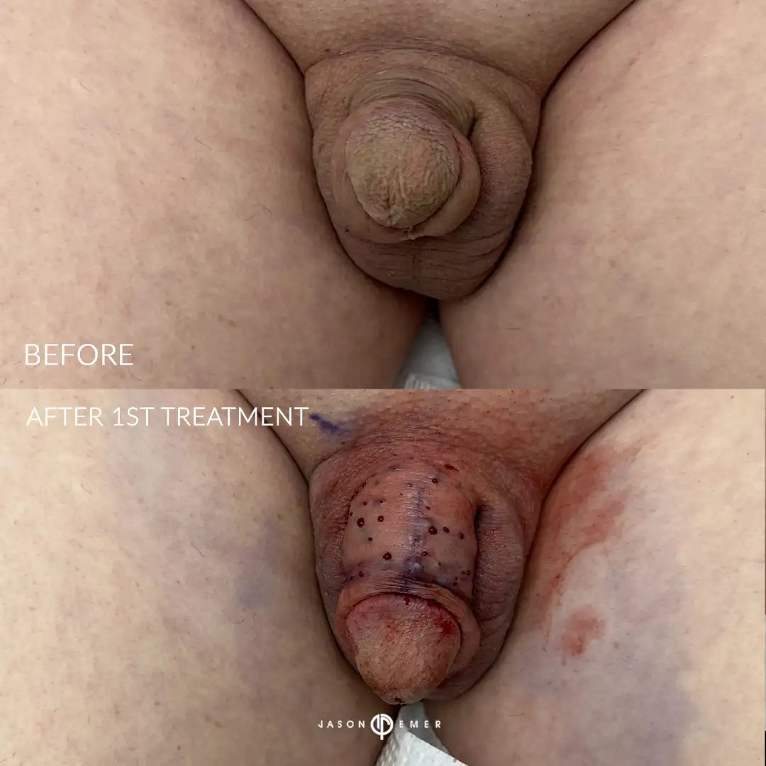 hj_BA_03